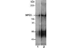 Western blot analysis of Npc1l1 in rat small intestine membrane preparations (Lane 1 : 2 ug/mL , Lane 2 : 4 ug/mL) with Npc1l1 polyclonal antibody . (NPC1L1 antibody  (AA 1000-1100))