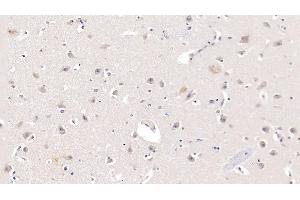 Detection of APOL2 in Human Cerebrum Tissue using Monoclonal Antibody to Apolipoprotein L2 (APOL2) (Apolipoprotein L 2 antibody  (AA 186-337))