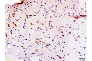 Formalin-fixed and paraffin embedded rat brain labeled with Anti-Sema3F/semaphorin 3F Polyclonal Antibody, Unconjugated  at 1:200 followed by conjugation to the secondary antibody and DAB staining.