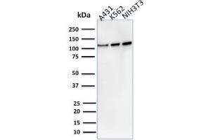 Western Blotting (WB) image for anti-Vinculin (VCL) (AA 174-322) antibody (ABIN6940866)