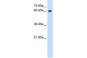 WB Suggested Anti-ZNF169 Antibody Titration:  0. (ZNF169 antibody  (Middle Region))