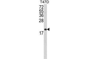 Western blot analysis of FAS Antibody (Center) in T47D cell line lysates (35ug/lane). (FAS antibody  (Middle Region))