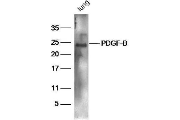 PDGFB antibody  (AA 155-210)
