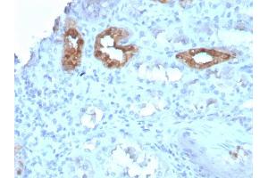 Immunohistochemistry (IHC) image for anti-Calbindin (CALB1) (AA 7-96) antibody (ABIN6940930)