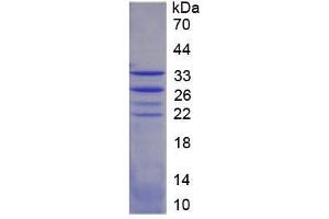 SDS-PAGE analysis of Mouse FOXO1 Protein. (FOXO1 Protein)