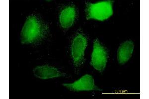 Immunofluorescence of  purified  MaxPab antibody to RRM2 on HeLa cell. (RRM2 antibody  (AA 1-389))