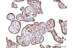 IHC analysis of RPS15A using anti-RPS15A antibody (ABIN7598954). (RPS15A antibody  (AA 1-113))