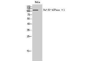 Western Blotting (WB) image for anti-Sodium Potassium ATPase, alpha1 (ATP1A1) (Ser23) antibody (ABIN3185759) (ATP1A1 antibody  (Ser23))