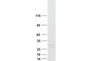 Validation with Western Blot (Apolipoprotein M Protein (APOM) (Myc-DYKDDDDK Tag))