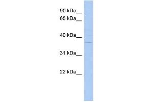 Host:  Rabbit  Target Name:  MARCH5  Sample Type:  U937 Whole Cell lysates  Antibody Dilution:  1. (MARCH5 antibody  (N-Term))
