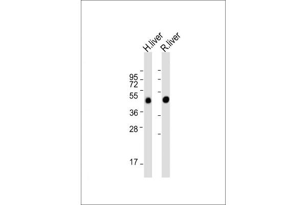 METTL4 抗体  (C-Term)
