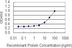 Detection limit for recombinant GST tagged SOX5 is 1 ng/ml as a capture antibody. (SOX5 antibody  (AA 181-230))