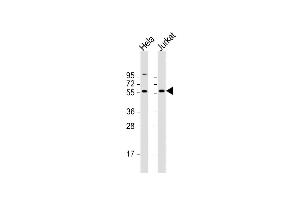 All lanes : Anti-CREB3L2 Antibody (C-term) at 1:2000 dilution Lane 1: Hela whole cell lysate Lane 2: Jurkat whole cell lysate Lysates/proteins at 20 μg per lane.