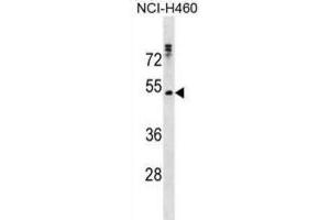 Western Blotting (WB) image for anti-Rh Family C Glycoprotein (RHCG) antibody (ABIN3000734) (RHCG antibody)