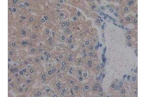 Detection of REG3b in Mouse Liver Tissue using Polyclonal Antibody to Regenerating Islet Derived Protein 3 Beta (REG3b) (REG3B antibody  (AA 27-175))