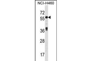 ICA1 Antibody (N-term) (ABIN1539626 and ABIN2848494) western blot analysis in NCI- cell line lysates (35 μg/lane). (ICA1 antibody  (N-Term))