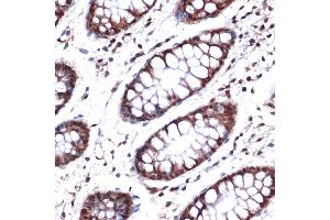 Immunohistochemistry of paraffin-embedded human colon using NUP153 Rabbit mAb (ABIN1512527, ABIN3023298, ABIN3023299 and ABIN7101477) at dilution of 1:100 (40x lens).