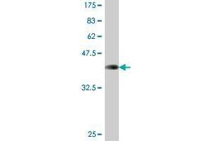 Western Blot detection against Immunogen (37. (COMMD5 antibody  (AA 125-224))