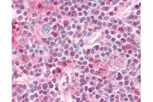 Immunohistochemistry (IHC) image for anti-Nuclear Receptor Subfamily 1, Group D, Member 1 (NR1D1) (Internal Region) antibody (ABIN1049129)