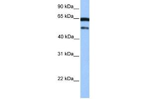 WB Suggested Anti-hCG_2042202 Antibody Titration:  0. (ZSCAN5B antibody  (C-Term))
