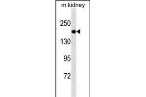 ACE Antibody (Ascites) ABIN1539969 western blot analysis in mouse kidney tissue lysates (35 μg/lane). (Angiotensin I Converting Enzyme 1 antibody  (AA 1274-1306))