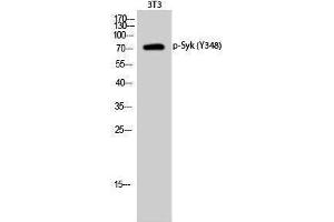 Western Blotting (WB) image for anti-Spleen tyrosine Kinase (SYK) (pTyr348) antibody (ABIN3179631) (SYK antibody  (pTyr348))