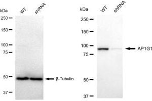 Western blotting analysis using AP1G1 antibody (ABIN7797508). (Recombinant gamma 1 Adaptin antibody)