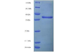 SDS-PAGE of protein expressed in E. (Cathepsin L Protein (AA 114-288) (His tag))