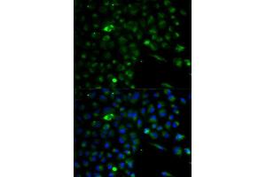 Immunofluorescence analysis of A549 cell using ALDH1A1 antibody. (ALDH1A1 antibody  (AA 48-147))