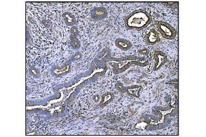 IHC analysis of CLPP using anti-CLPP antibody (ABIN5693176). (CLPP antibody  (AA 184-247))