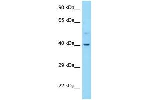 WB Suggested Anti-CNR2 Antibody Titration: 1. (CNR2 antibody  (C-Term))