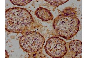 IHC image of ABIN7174015 diluted at 1:100 and staining in paraffin-embedded human placenta tissue performed on a Leica BondTM system. (CSK antibody  (AA 325-416))