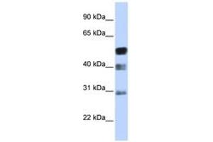 Image no. 1 for anti-Transcription Factor AP-2 beta (Activating Enhancer Binding Protein 2 Beta) (TFAP2B) (AA 35-84) antibody (ABIN6742379) (TFAP2B antibody  (AA 35-84))