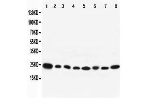 Western Blotting (WB) image for anti-RAB8A, Member RAS Oncogene Family (RAB8A) (AA 170-183), (C-Term) antibody (ABIN3042554)