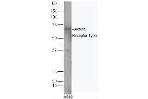 Human A549 cell lysates probed with Rabbit Anti-ACVR2B/ACTR-IIB Polyclonal Antibody, Unconjugated  at 1:5000 for 90 min at 37˚C. (ACVR2B antibody  (AA 45-150))