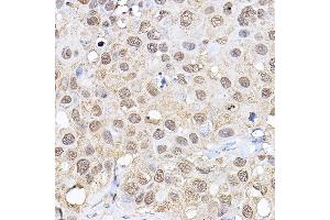 Immunohistochemistry (IHC) image for anti-Ribosomal Protein S6 Kinase, 70kDa, Polypeptide 1 (RPS6KB1) (AA 1-352) antibody (ABIN3023169)