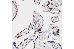 Immunohistochemistry (IHC) image for anti-Histone Deacetylase 9 (HDAC9) (AA 1-100) antibody (ABIN3022054)