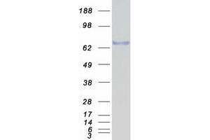 Western Blotting (WB) image for Nuclear Receptor Subfamily 4, Group A, Member 3 (NR4A3) (Transcript Variant 3) protein (Myc-DYKDDDDK Tag) (ABIN2727601)