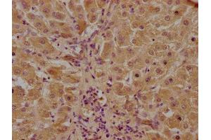 IHC image of ABIN7146046 diluted at 1:100 and staining in paraffin-embedded human liver tissue performed on a Leica BondTM system. (CLEC1A antibody  (AA 66-316))