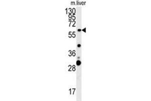 ZCCHC5 Antibody (N-term) western blot analysis in mouse liver tissue lysates (15 µg/lane).