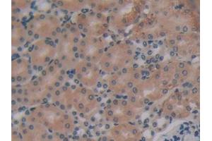 Immunohistochemistry (IHC) image for anti-Eukaryotic Translation Initiation Factor 2-alpha Kinase 2 (EIF2AK2) (AA 205-495) antibody (ABIN2117704)
