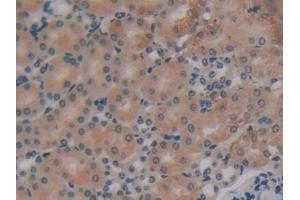 DAB staining on IHC-P; Samples: Mouse Kidney Tissue (EIF2AK2 antibody  (AA 205-495))
