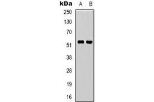 Western blot analysis of GPR37L1 expression in A549 (A), Hela (B) whole cell lysates. (GPR37L1 antibody  (N-Term))