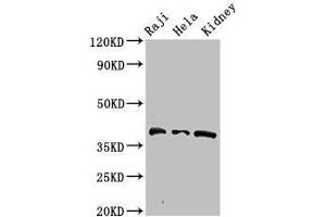 Western Blot Positive WB detected in: Raji whole cell lysate, Hela whole cell lysate, Mouse kidney tissue All lanes: RFC4 antibody at 2. (RFC4 antibody  (AA 9-142))