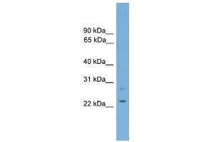 RBM11 antibody used at 1 ug/ml to detect target protein. (RBM11 antibody  (Middle Region))