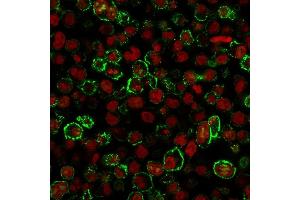 Protein Array (PAr) image for anti-Membrane-Spanning 4-Domains, Subfamily A, Member 1 (MS4A1) antibody (ABIN6941111)