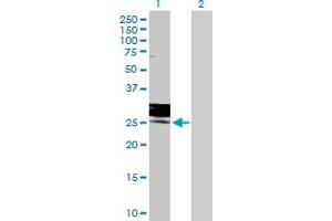 FOLR3 antibody  (AA 1-245)