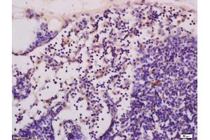 Formalin-fixed and paraffin embedded rat pancreas tissue labeled with Anti-cGMP Polyclonal Antibody, Unconjugated (ABIN750733) at 1:400, followed by conjugation to the secondary antibody and DAB staining (Cyclic GMP antibody)