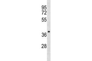 NDRG4 antibody western blot analysis in CEM lysate. (NDRG4 antibody  (AA 193-220))