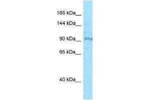 WB Suggested Anti-BBS9 Antibody Titration: 1. (BBS9 antibody  (N-Term))